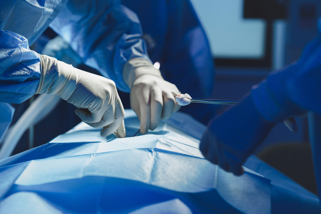 Close up of surgeon with nurse and and assistant during operation.